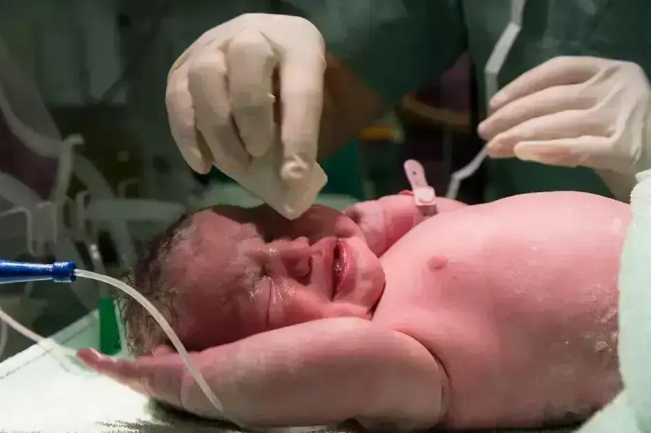 Cerclagem Uterina: Indicações e Como Pode Ajudar na Gravidez de Risco