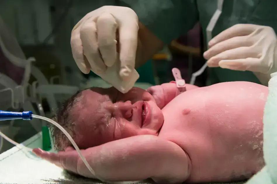 Pré-eclâmpsia: O que É, Como Identificar e a Relação com o Parto Prematuro